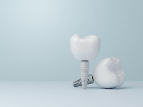 Keramikimplantate: Für wen metallfreier Zahnersatz interessant sein kann